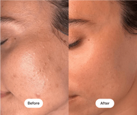 Dr. Melaxin Korean Black Rice Peeling Ampoule - Exfoliating Face Remove Dead Skin Cells Blackheads Facial Skincare